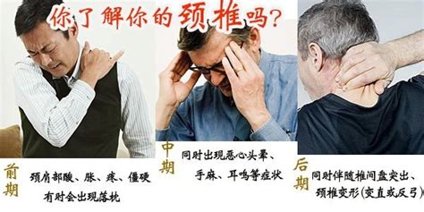 反弓|医生医生，我脖子都反弓了，是不是很严重啊？